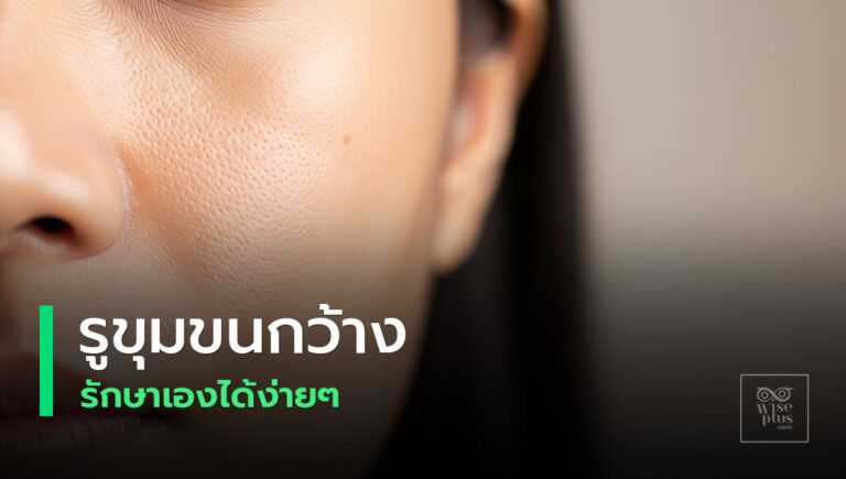 ปกบทความรูขุมขนกว้างและวิธีกระชับผิว