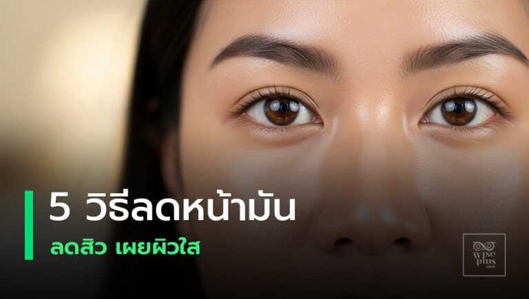 ผิวมันรูขุมขนกว้างและมันส่วนเกินบริเวณทีโซน