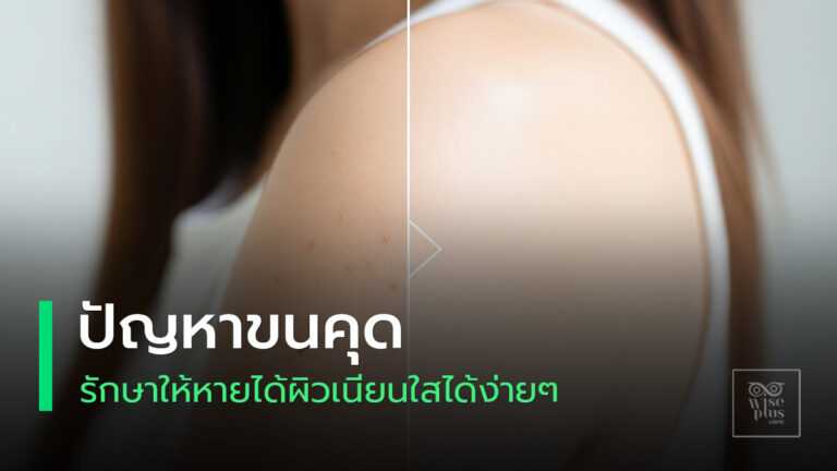 ผิวเรียบเนียนไร้ขนคุดด้วยวิธีธรรมชาติ