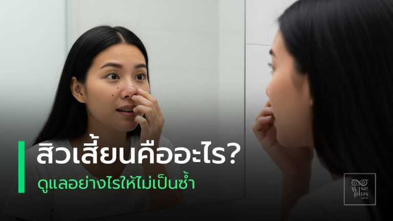 สิวเสี้ยนและวิธีดูแลผิวให้เรียบเนียนอย่างถูกวิธี