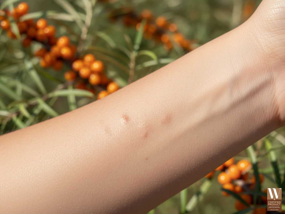 ซีบัคธอร์นช่วยปรับผิวให้กระจ่างใสและลดเลือนรอยดำ