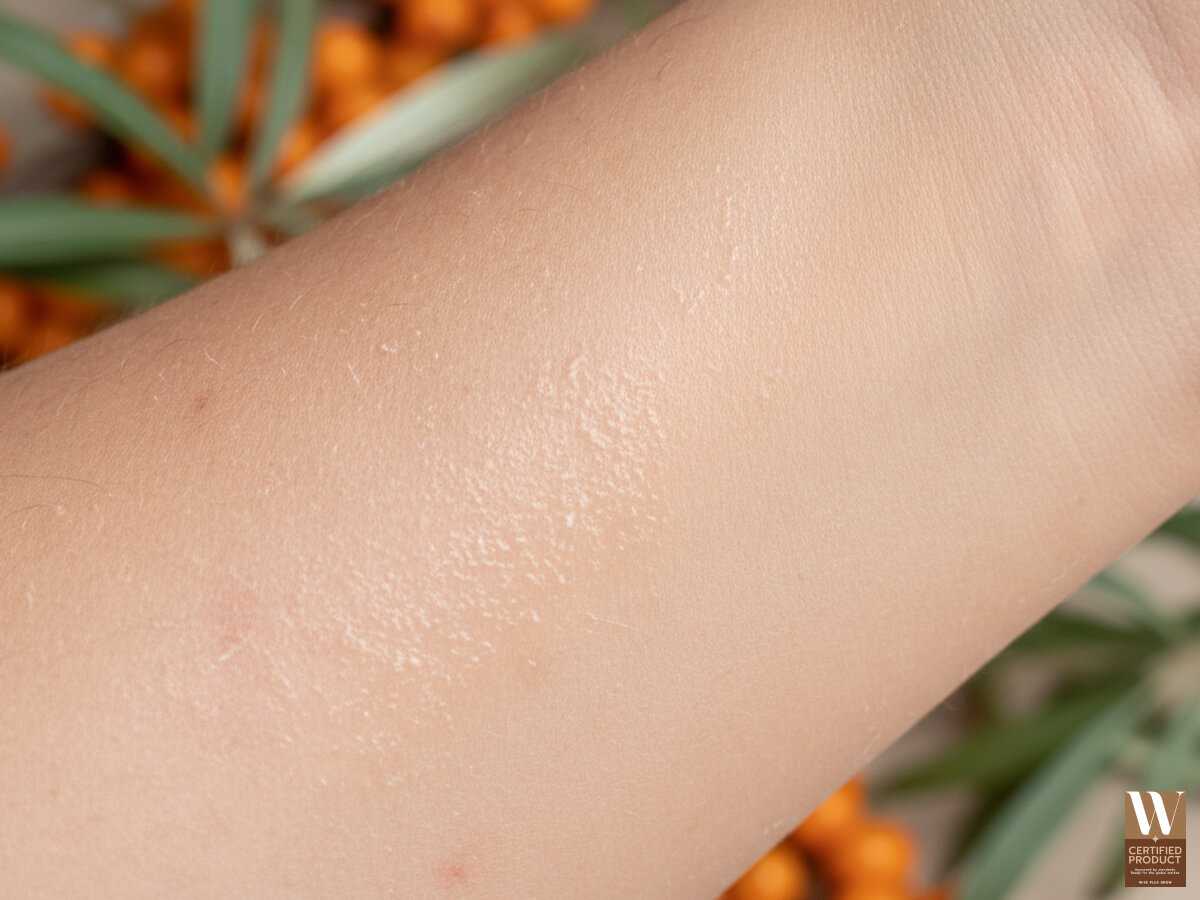 ซีบัคธอร์นช่วยฟื้นฟูผิวแห้งและลดการระคายเคือง