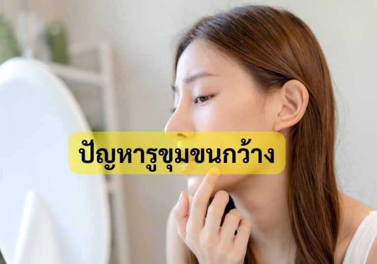 ปัญหารูขุมขนกว้าง