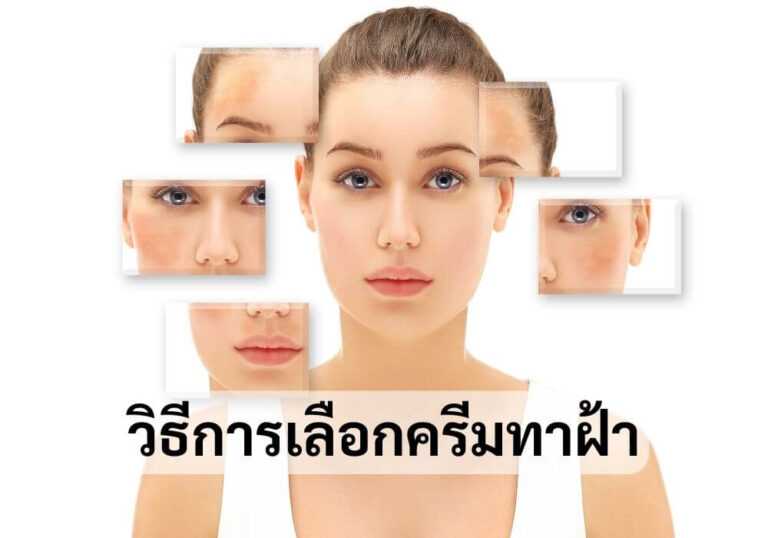วิธีการเลือกครีมทาฝ้า