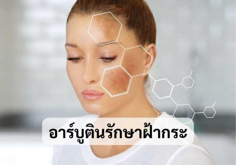 อาร์บูตินรักษาฝ้ากระ