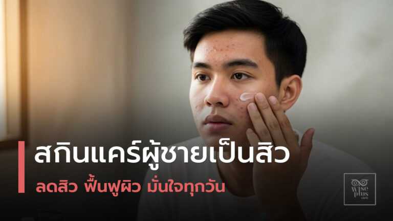 สกินแคร์สำหรับผู้ชายที่มีปัญหาสิว