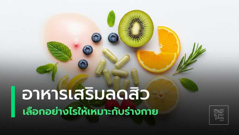 อาหารเสริมลดสิวเพื่อผิวหน้าเนียนใส