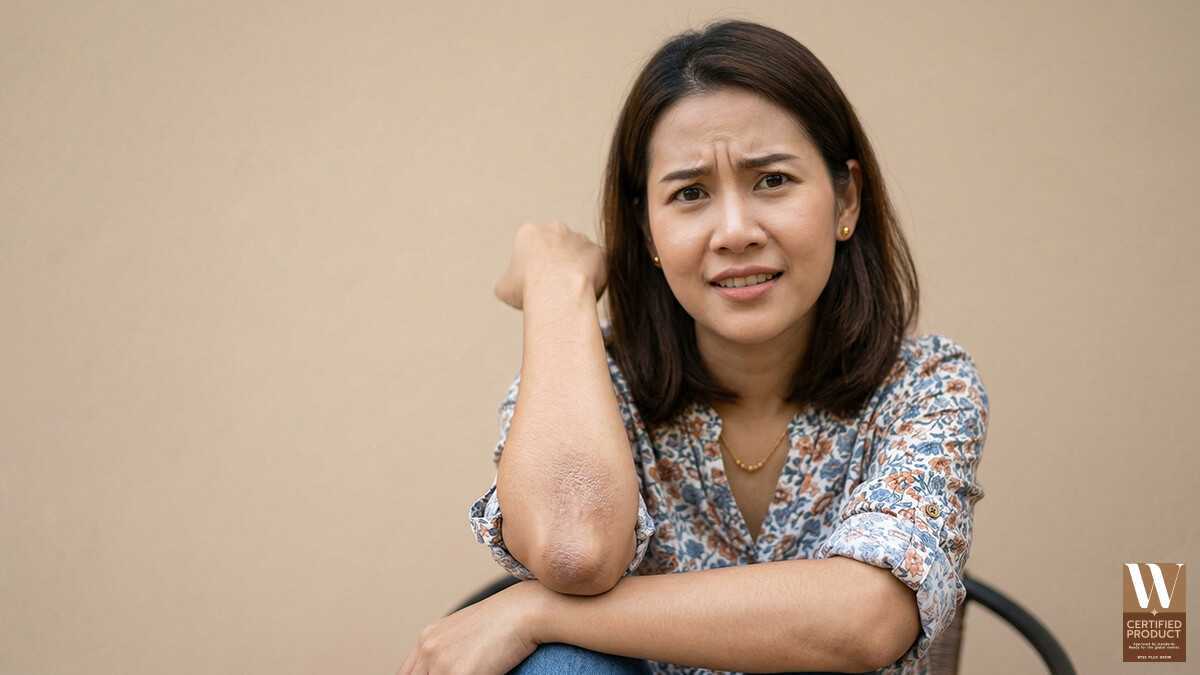 ผิวหยาบกร้านคือภาวะผิวขาดความชุ่มชื้น