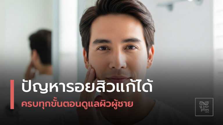 สกินแคร์ผู้ชายลดรอยสิวและจุดด่างดำ