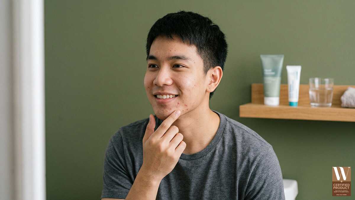 สาเหตุสิวในผู้ชาย