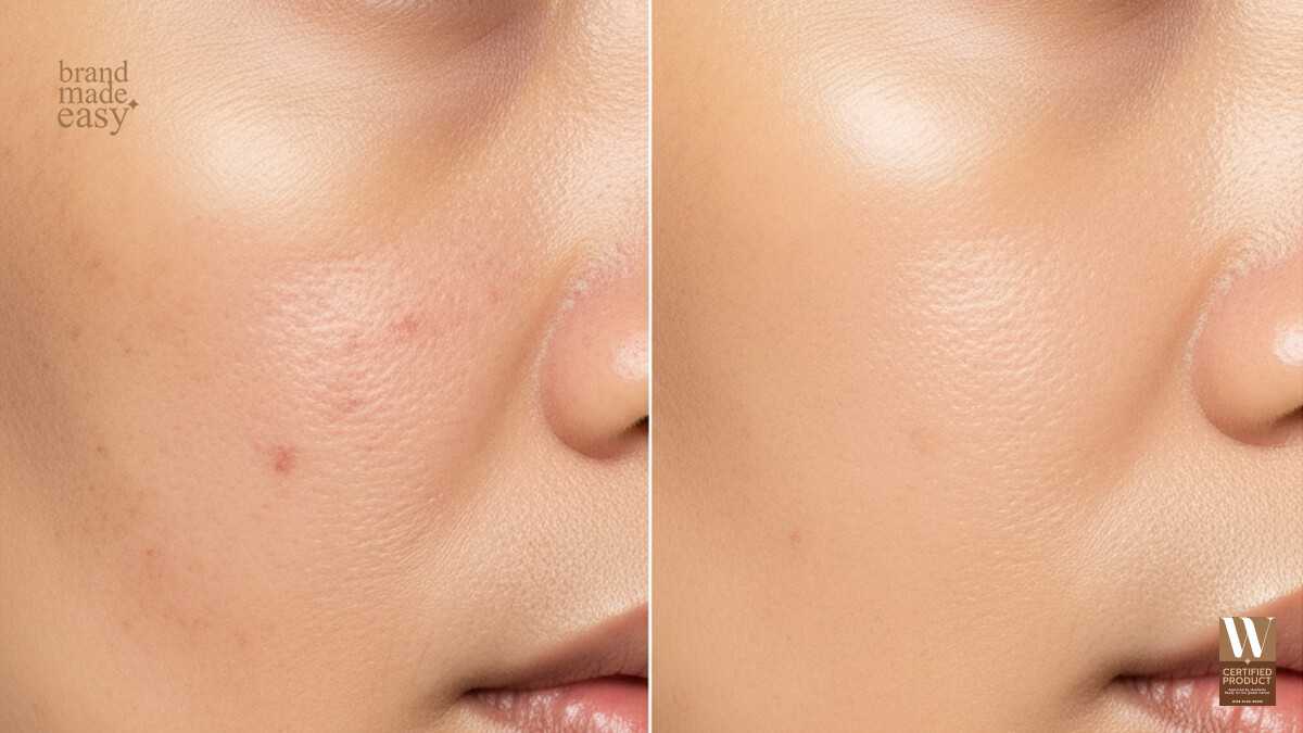 ผิวหน้าก่อนและหลังใช้ AHA ลดรอยดำและจุดด่างดำ