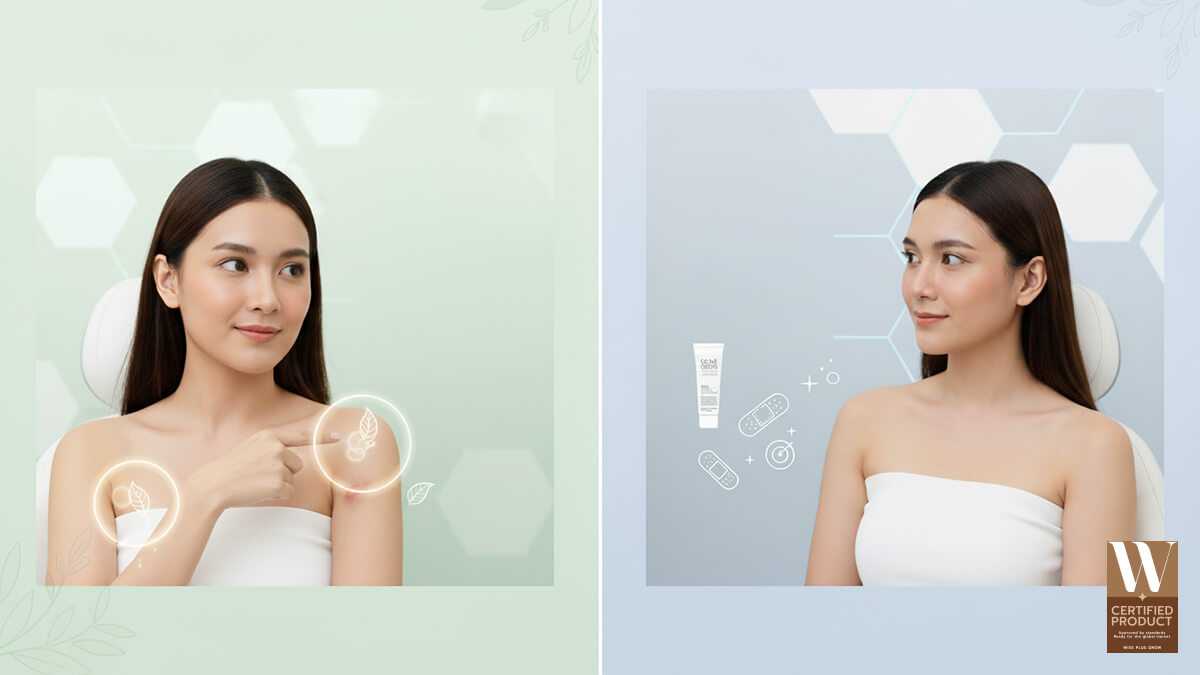 เข้าใจผิวและรอยแผลเป็นก่อนเลือกวิธีดูแลที่เหมาะกับคุณ