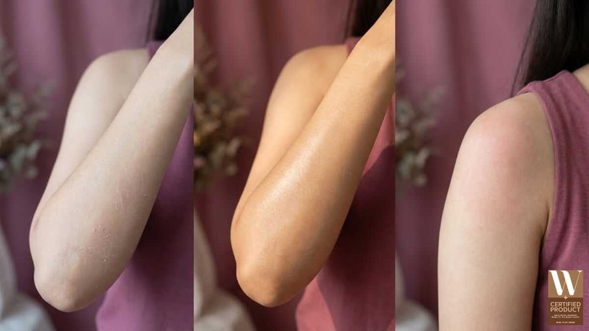 ประเภทสภาพผิวที่เหมาะกับการใช้สบู่ฟรุตตี้เบอร์รี่