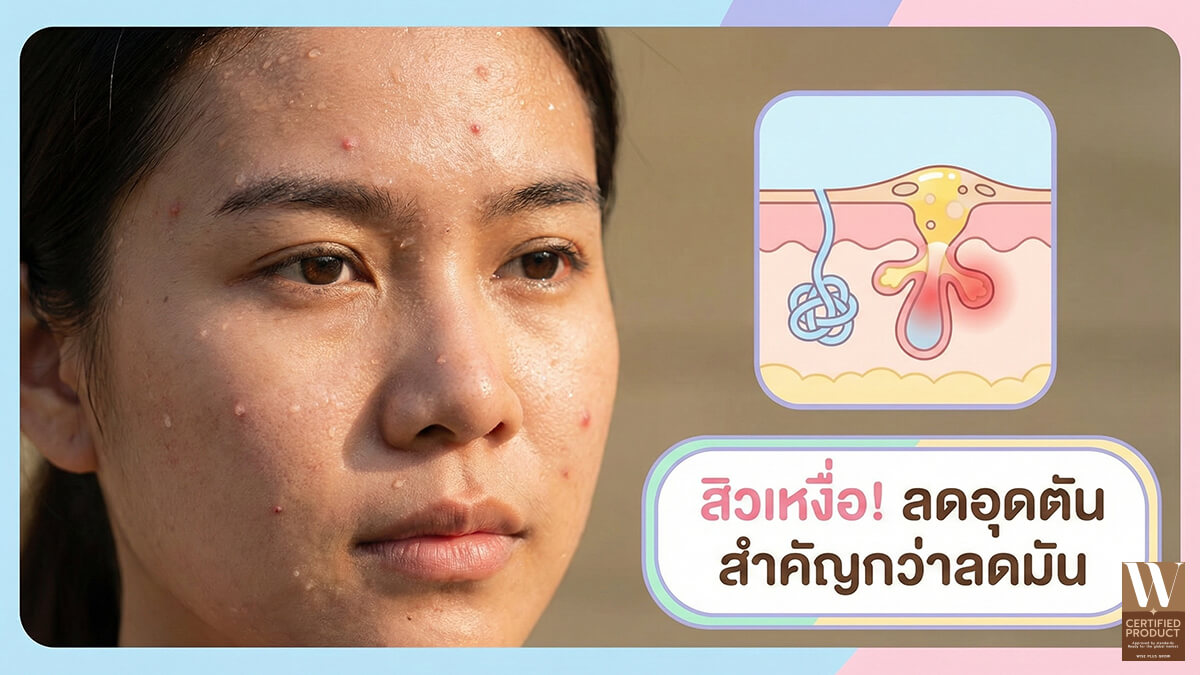 กระบวนการเกิดสิวจากเหงื่อและความร้อนในเชิงโครงสร้างผิวและการทำงานของรูขุมขน