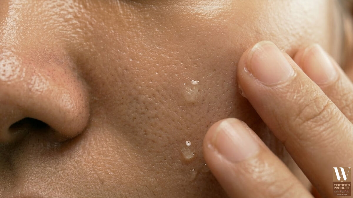 กลไกของรูขุมขนที่เกี่ยวข้องกับการเกิดสิวบนผิวหน้า