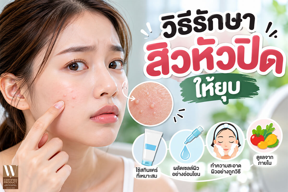 การดูแลผิวหน้าลดสิวหัวปิดและป้องกันรูขุมขนอุดตัน