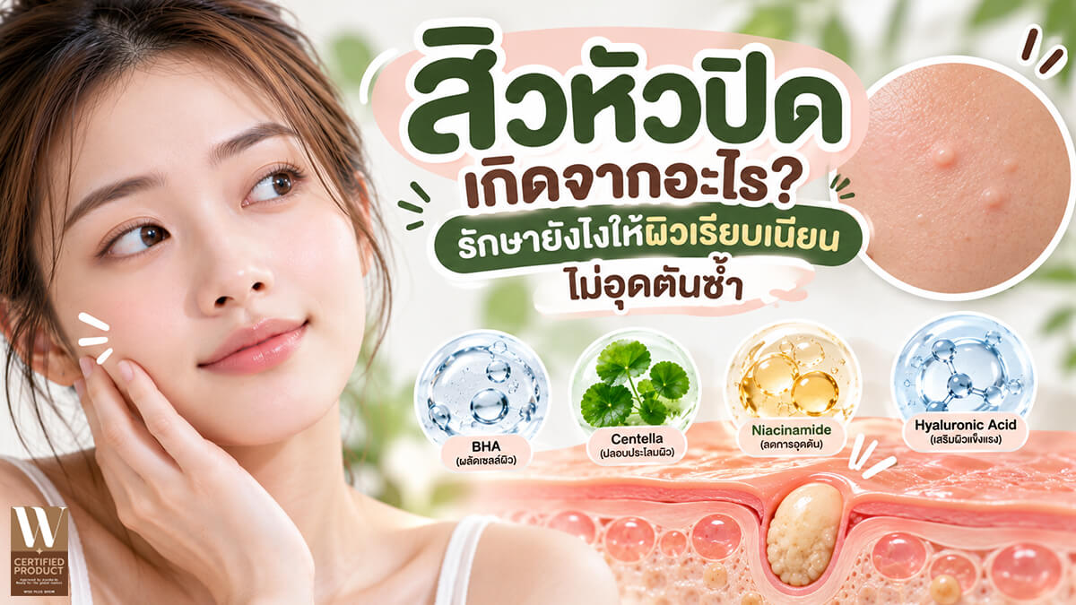 สิวหัวปิดเป็นตุ่มเล็กใต้ผิวบริเวณใบหน้า
