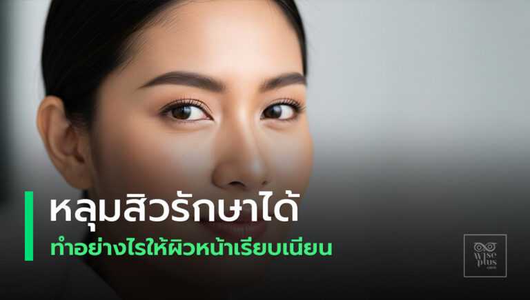 ทางเลือกการรักษาหลุมสิวให้ผิวเรียบเนียน