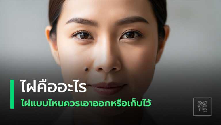 แนวทางกำจัดไฝอย่างปลอดภัยโดยแพทย์