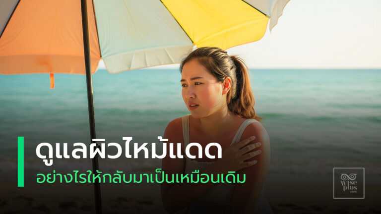 ผิวไหม้แดดและวิธีฟื้นฟูผิวให้สวยใสอย่างปลอดภัย