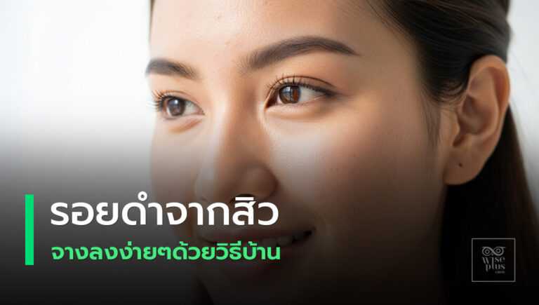 วิธีลดรอยดำจากสิวแบบบ้านๆ ให้ผิวใสขึ้น