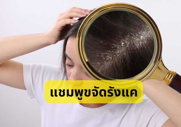 แชมพูขจัดรังแค