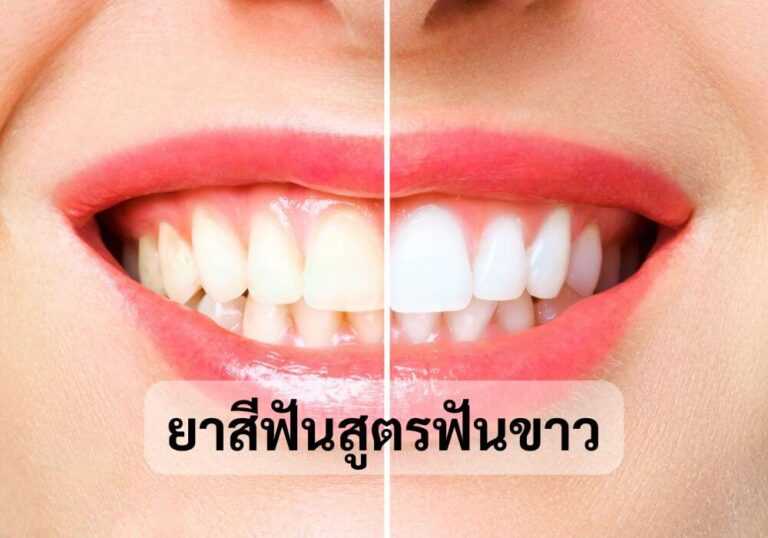 ยาสีฟันสูตรฟันขาว