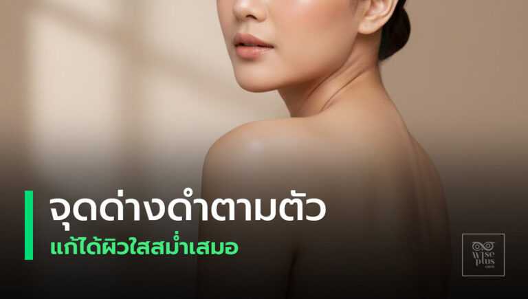 จุดด่างดำตามตัวและแนวทางดูแลผิวให้สม่ำเสมอ