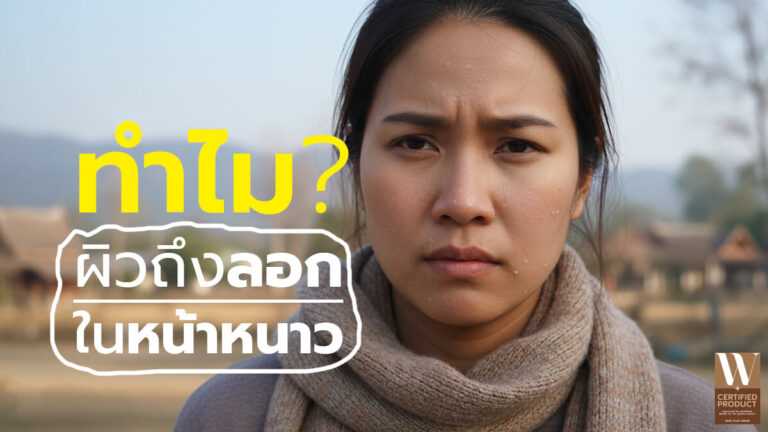ทำไมผิวลอกในหน้าหนาวและวิธีเลือกสบู่ให้เหมาะกับฤดูเย็น