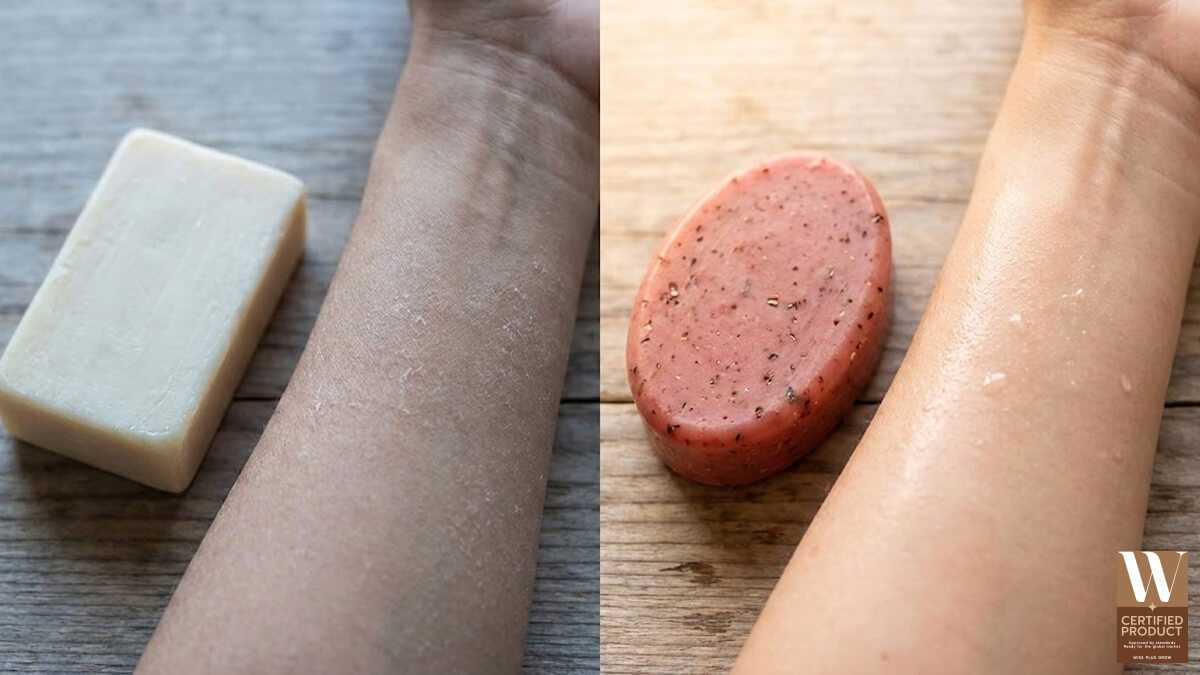 เปรียบเทียบสบู่โสมกลูต้าทับทิมกับสบู่ผิวขาวแรงที่ทำให้ผิวแห้งลอก