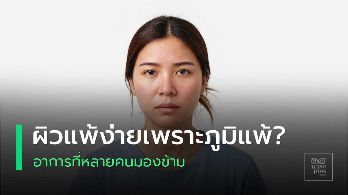 ผิวแดงลอกไว สื่อความเชื่อมโยงผิวแพ้ง่ายกับภูมิแพ้