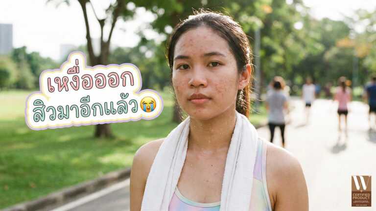สาเหตุของสิวจากเหงื่อ การออกกำลังกาย และอากาศร้อน พร้อมแนวทางดูแลผิวให้เหมาะสม
